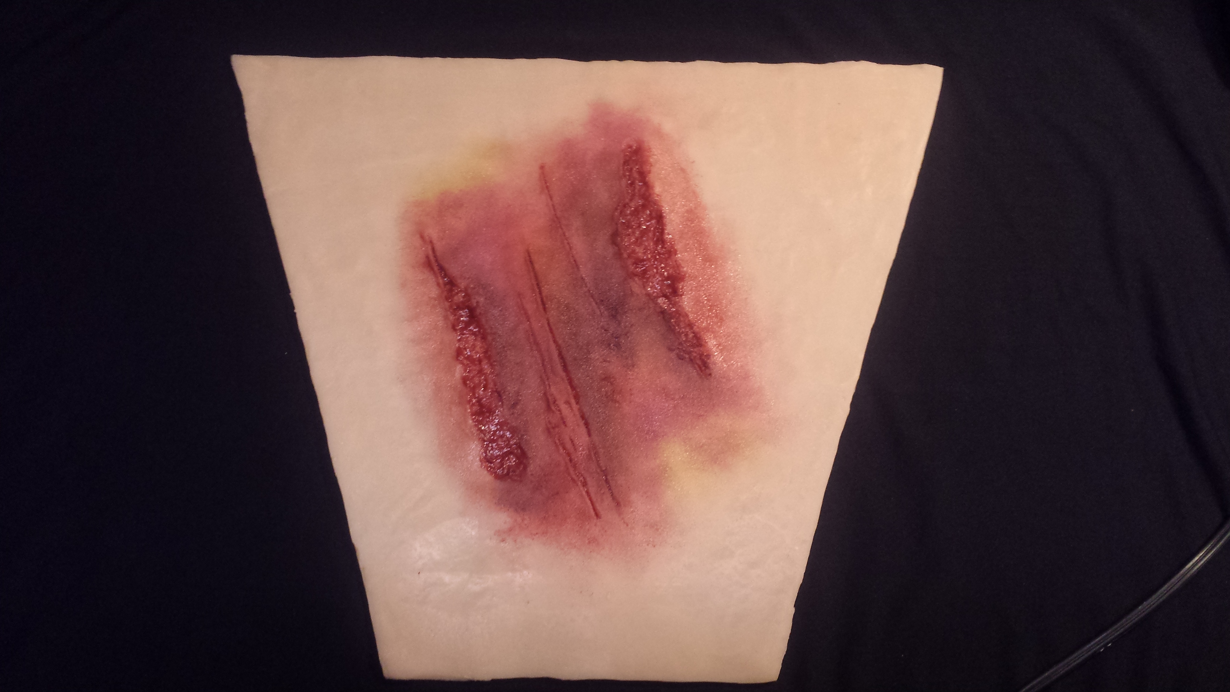 Lacerations with Bruising (Leg 13″ x 12-1/2″)