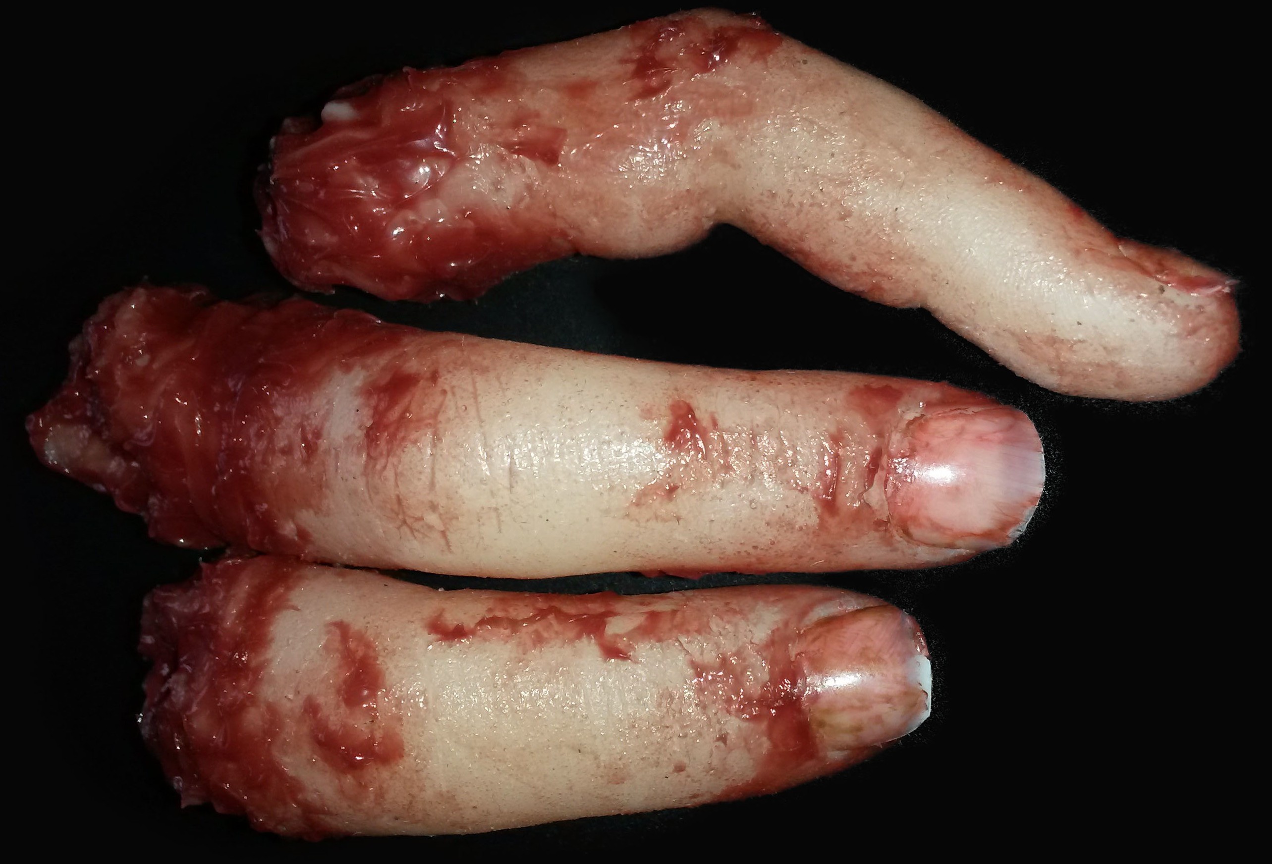 Finger (Specific digits may be requested)